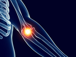 3-d graphic of bones in the arm with elbow highlighted to represent pain from golf & tennis elbow